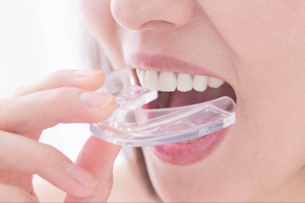 顎関節症の主な治療としてマウスピースを使用する女性